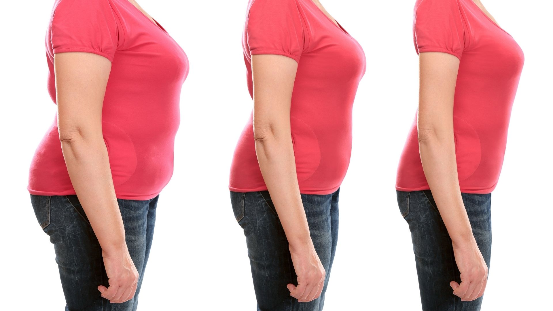 Advantages of Gastric Bypass are