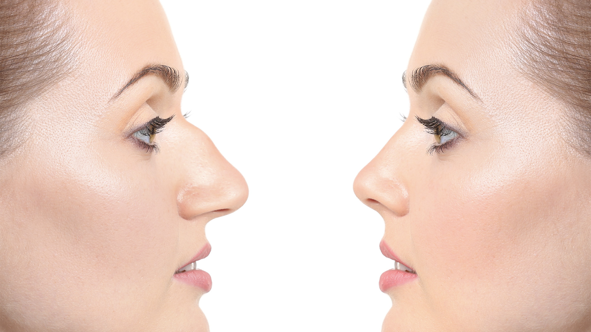 nose aesthetics