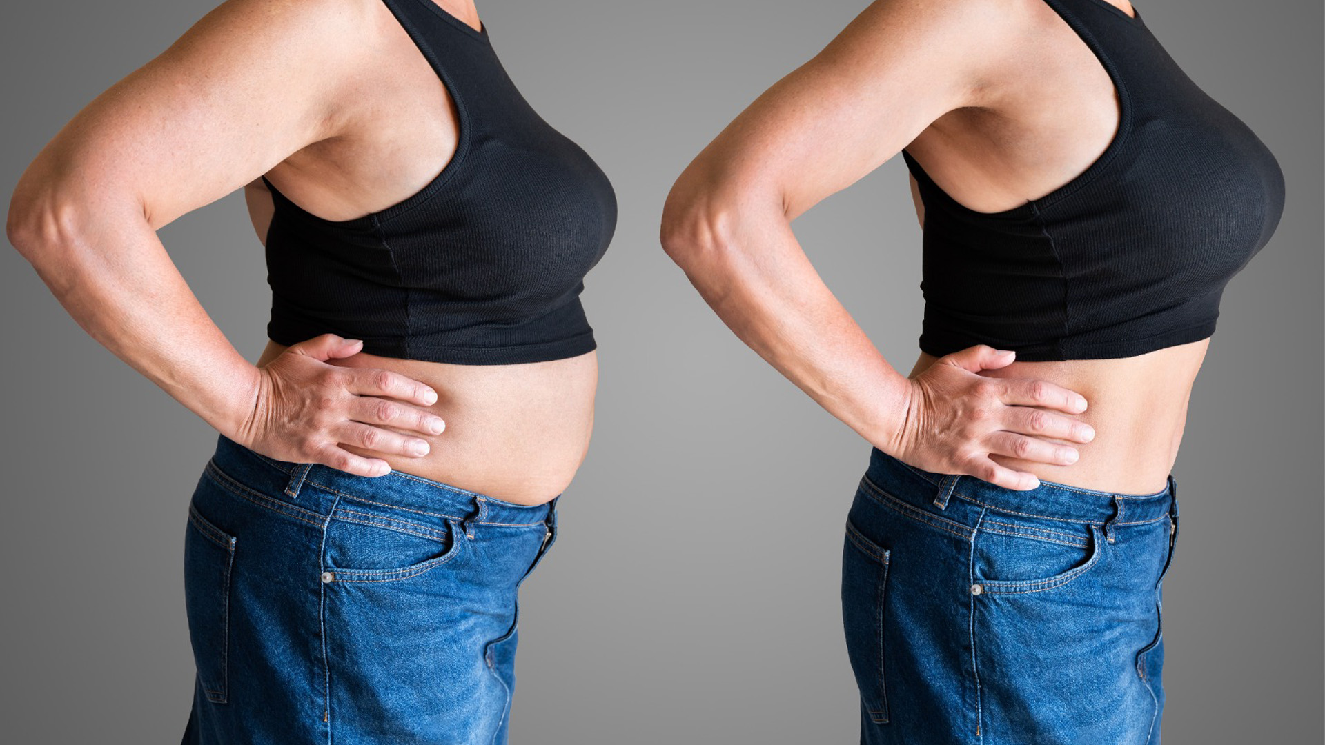 Tummy Tuck 2 tummy tuck