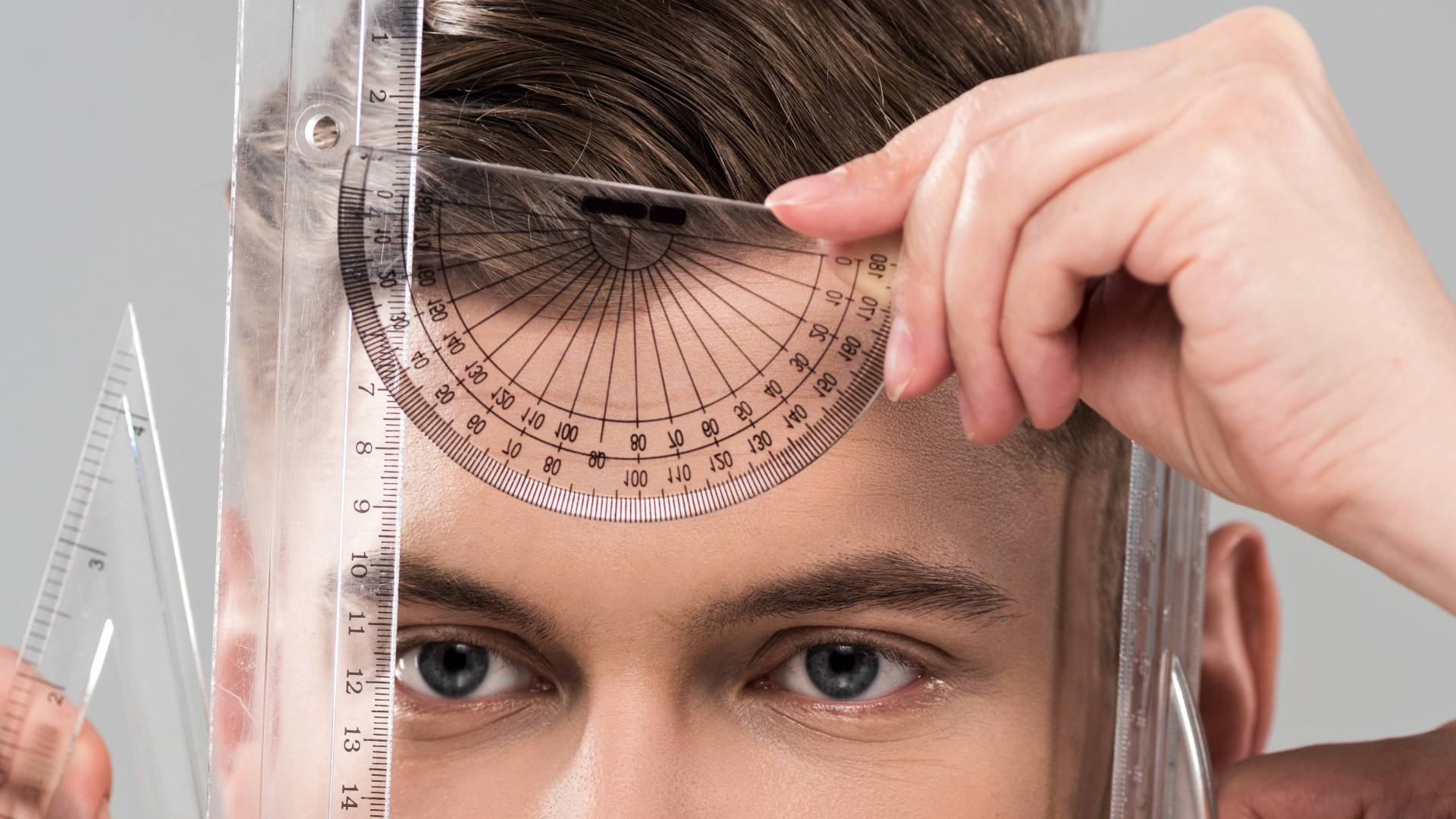 Forehead Reduction 3 Forehead Reduction