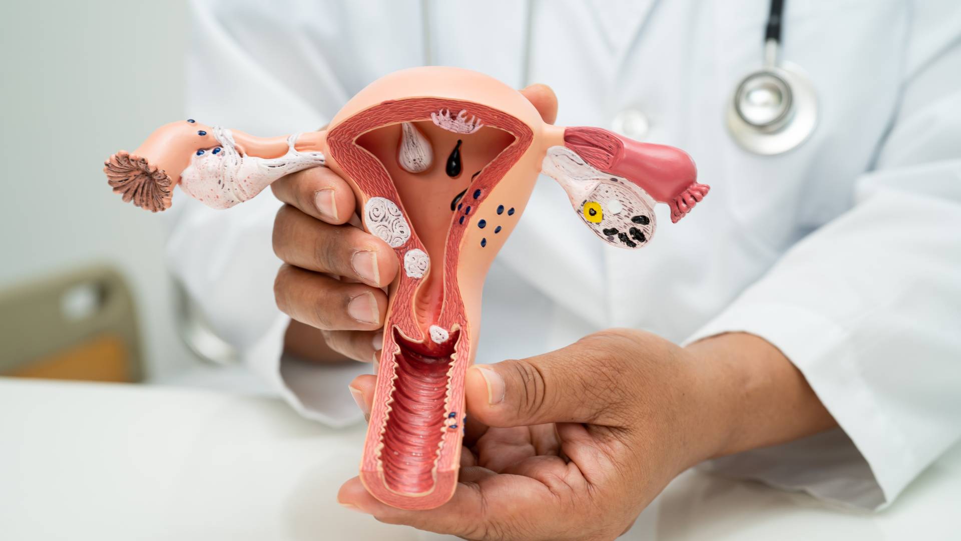 Vagina Aufräumen 3 Straffung der Vagina