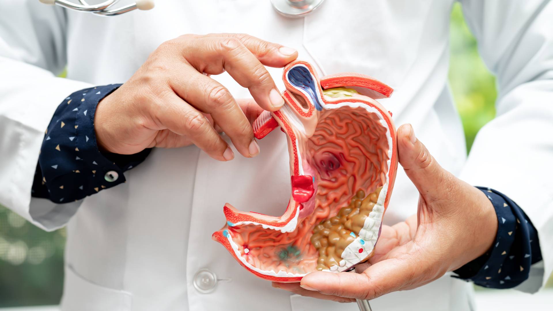 Gastric Bypass 3 Gastric Bypass