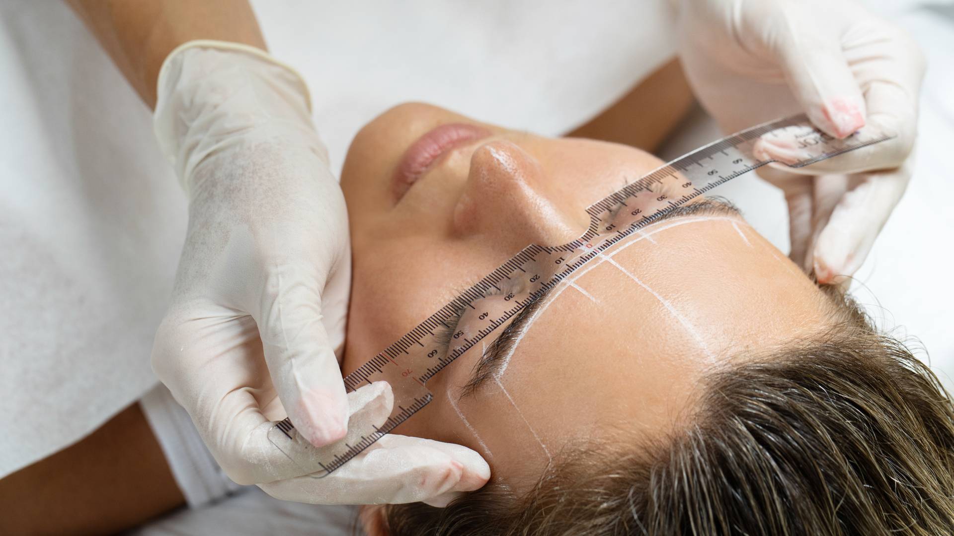 Brow Lift Aesthetics