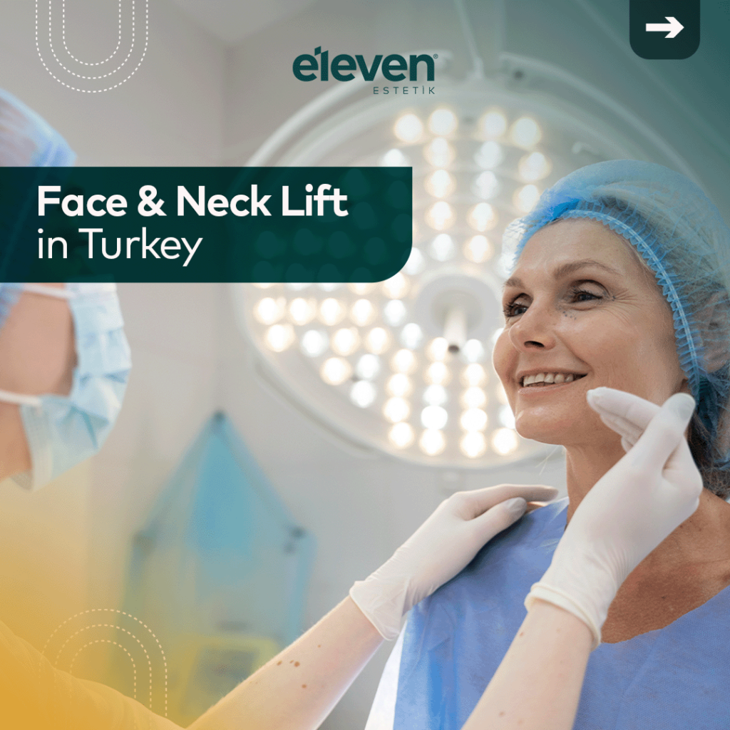 face and neck lift