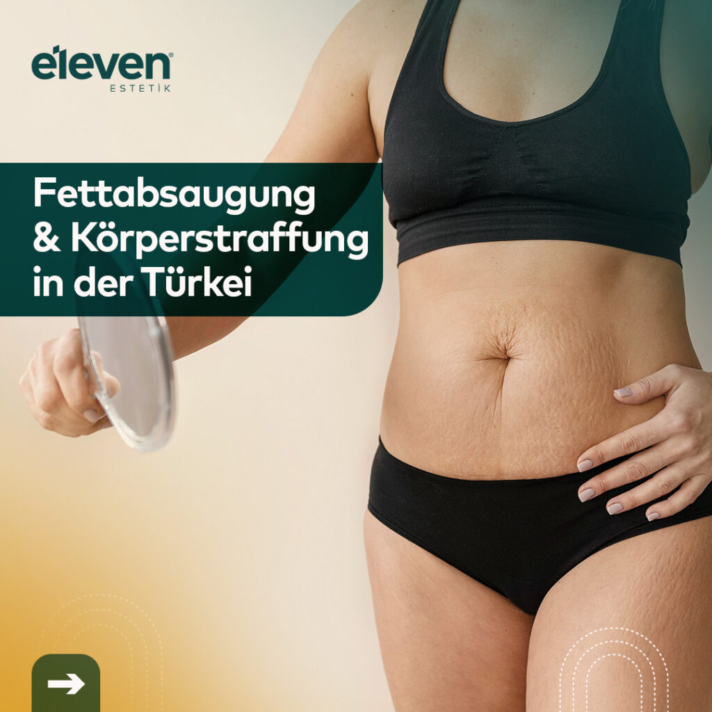 liposuction 01 de Fettentfernung und Körperstraffung