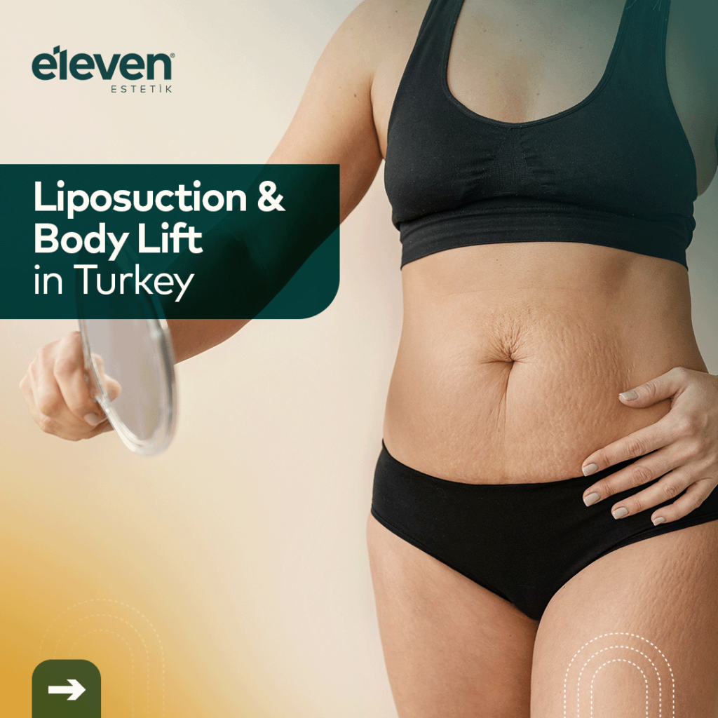 liposuction